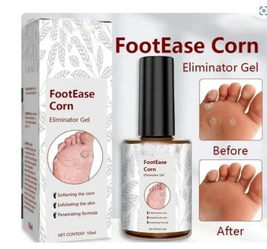 Feet Corn Removal Serum 30ml (Pack of 1)