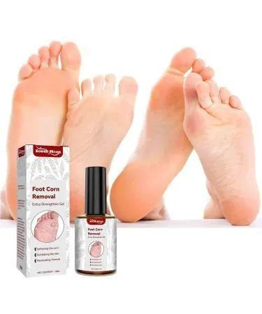 Feet Corn Removal Serum 30ml (Pack of 1)